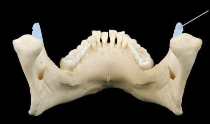 <p><span>Name the section in blue? (posterior view)</span></p>