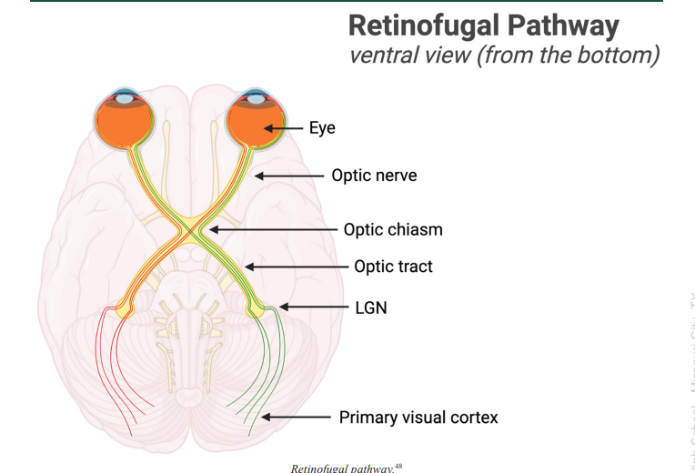 <p>Optic Tract</p>