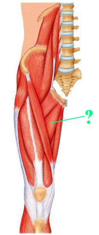 <p><span>Identify the indicated muscle.</span></p>