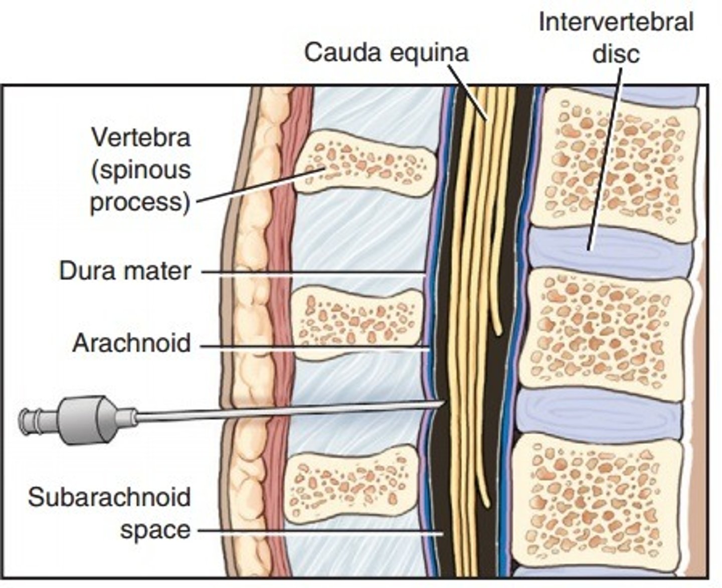 <p>A procedure for examining cerebrospinal fluid, typically done between L3 and L4 or L4 and L5.</p>