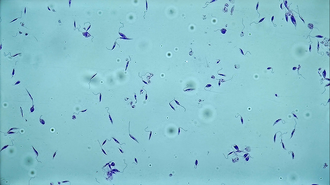 <p><span data-name="microscope" data-type="emoji">🔬</span><span data-name="petri_dish" data-type="emoji">🧫</span><strong><span> </span>Na podstawie zdjęcia preparatu:</strong></p><p></p><ul><li><p><span data-name="book" data-type="emoji">📖</span><span> </span>rozpoznaj gatunek pasożyta;</p></li></ul><p></p><ul><li><p><span data-name="recycle" data-type="emoji">♻</span><span> </span>rozpoznaj wszystkie formy rozwojowe;</p></li></ul><p></p><ul><li><p><span data-name="microbe" data-type="emoji">🦠</span><span> </span>wskaż organelle i cechy charakterystyczne dla danego gatunku;</p></li></ul><p></p><ul><li><p><span data-name="mask" data-type="emoji">😷</span><span> </span>nazwij chorobę, którą pasożyt wywołuje.</p></li></ul><p></p>