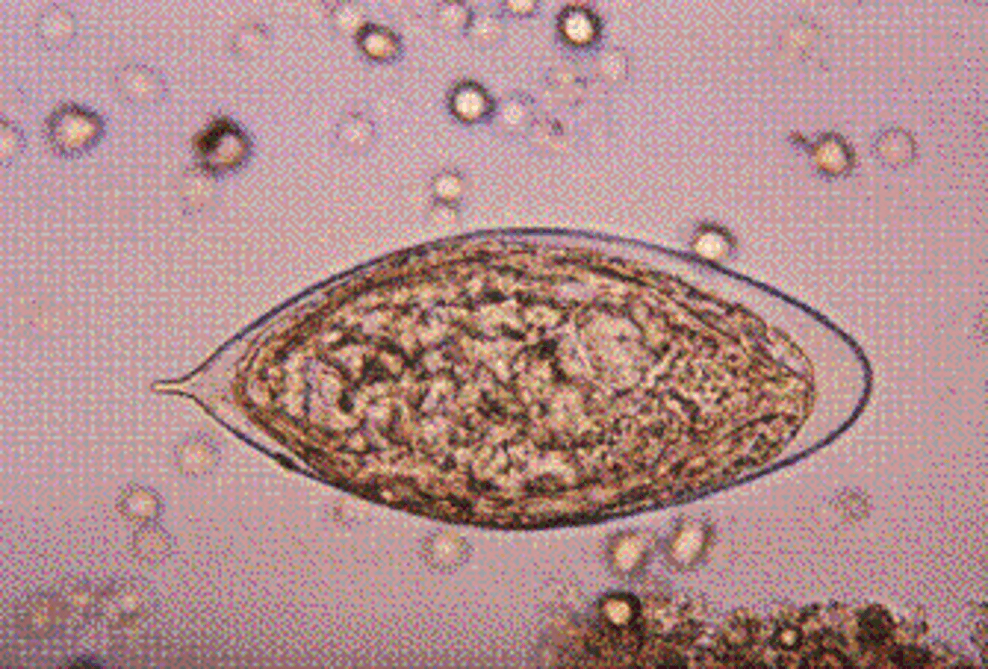 <p>c.S. haematobium.</p><p>S. haematobium, which is primarily found in the Nile Valley, the Mideast, and East Africa, lives in the veins surrounding the bladder. Diagnosis is made by finding embryonated eggs in the urine. S. haematobium eggs are elongated and 110 to 170 μm by 40 to 70 μm, and have a terminal spine. The best time to collect the eggs in urinary schistosomiasis is during peak excretion time in early afternoon (12 PM to 2 PM).</p>