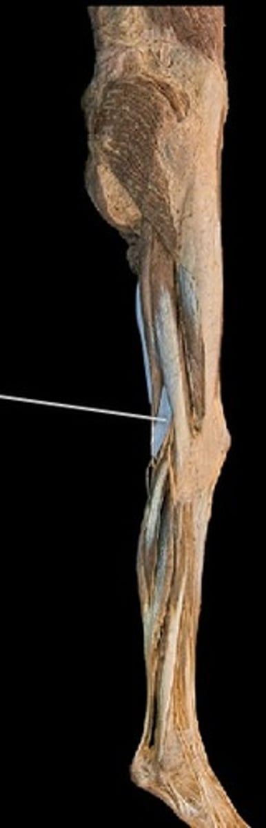<p>What muscle is this?</p>