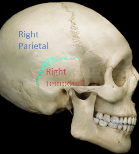 <p>connects the parietal and the temporal bone (curved)</p>