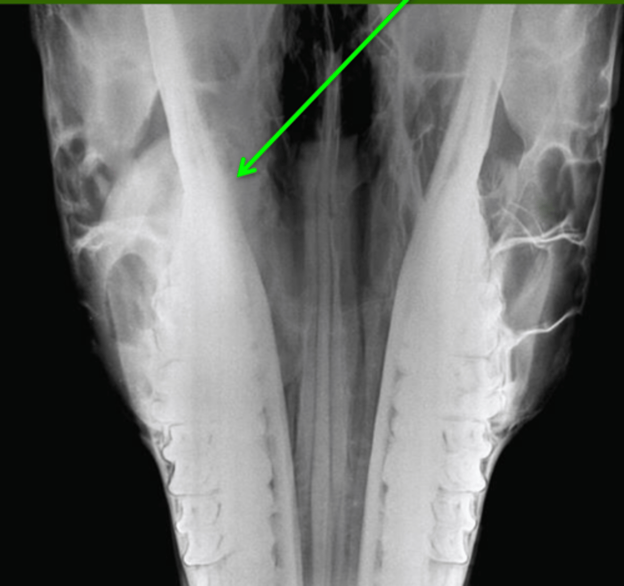 <p>Identify the pathology?</p>