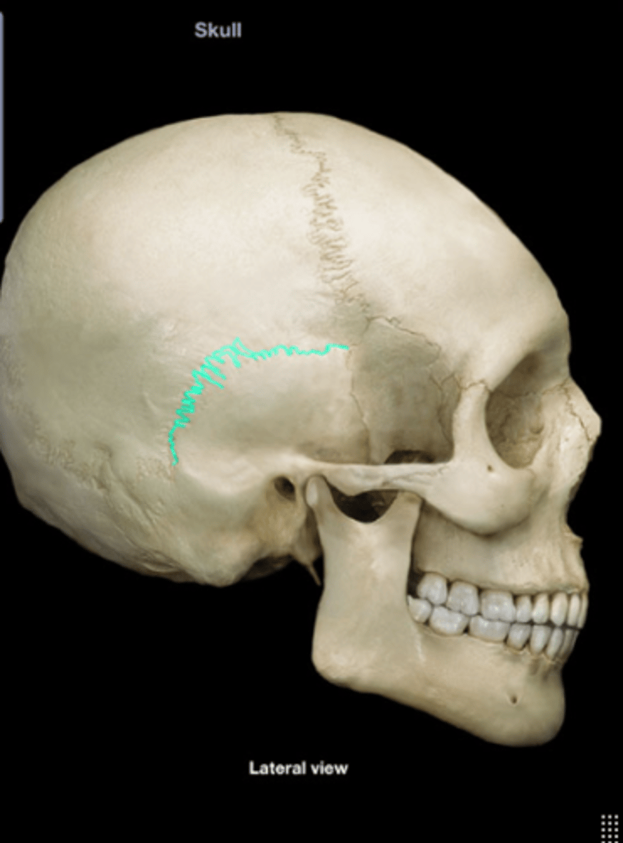 <p>Suture between parietal and temporal bones.</p>
