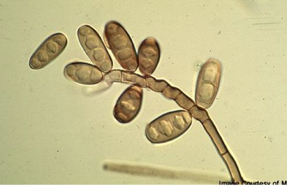 <p>Microscopic: elongated conidiophores, oblong conidia with 3 to 5 separation</p><p>Colony: Gray, brown, or black with brown. Reverse black.</p>