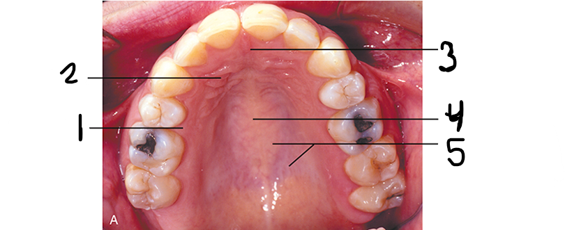 <p>Label the land marks of the hard palate (roof of mouth) from 1-5</p>