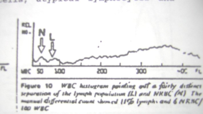 What can cause abnormal WBC histograms