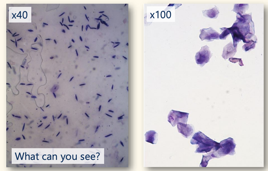 <p>Low power normal skin cytology what can you see?</p>