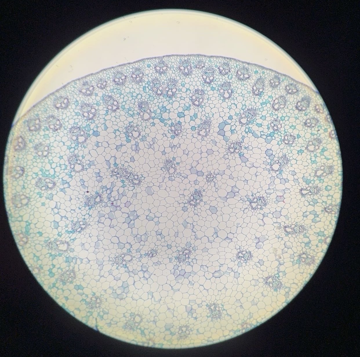 <p><span>What is this organism?</span></p>