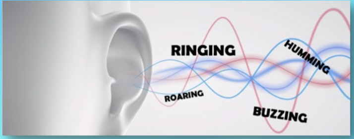 <p>Sound perception in <u>absence of stimulus</u></p><ul><li><p>Linked to <strong>hyperexcitable</strong> and elevated spontaneous activity in auditory system</p></li><li><p>Associated with: hearing loss, anxiety, exposure to loud noise, ototoxic drugs</p></li><li><p>no cure, treat w white noise or sound masking machines </p></li></ul><p></p>