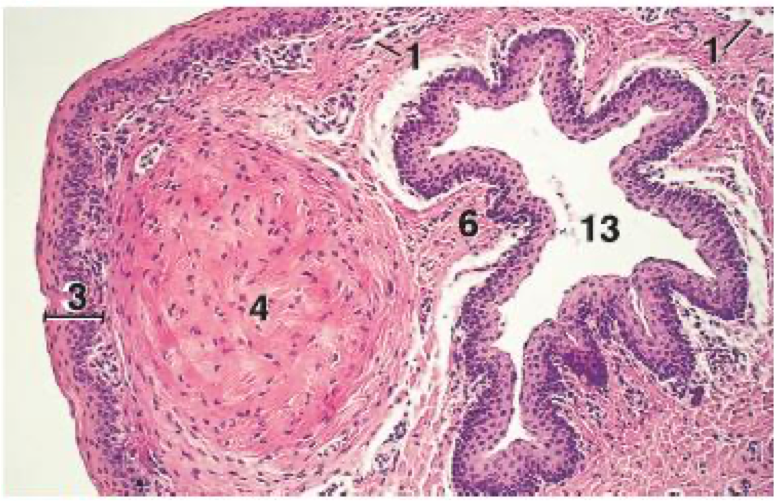 <p>What organ is this a cross-section?</p>