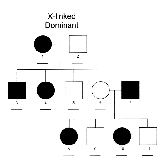 x-linked dominant pedigree