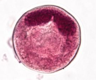 <p>Identify the organism and stage</p>