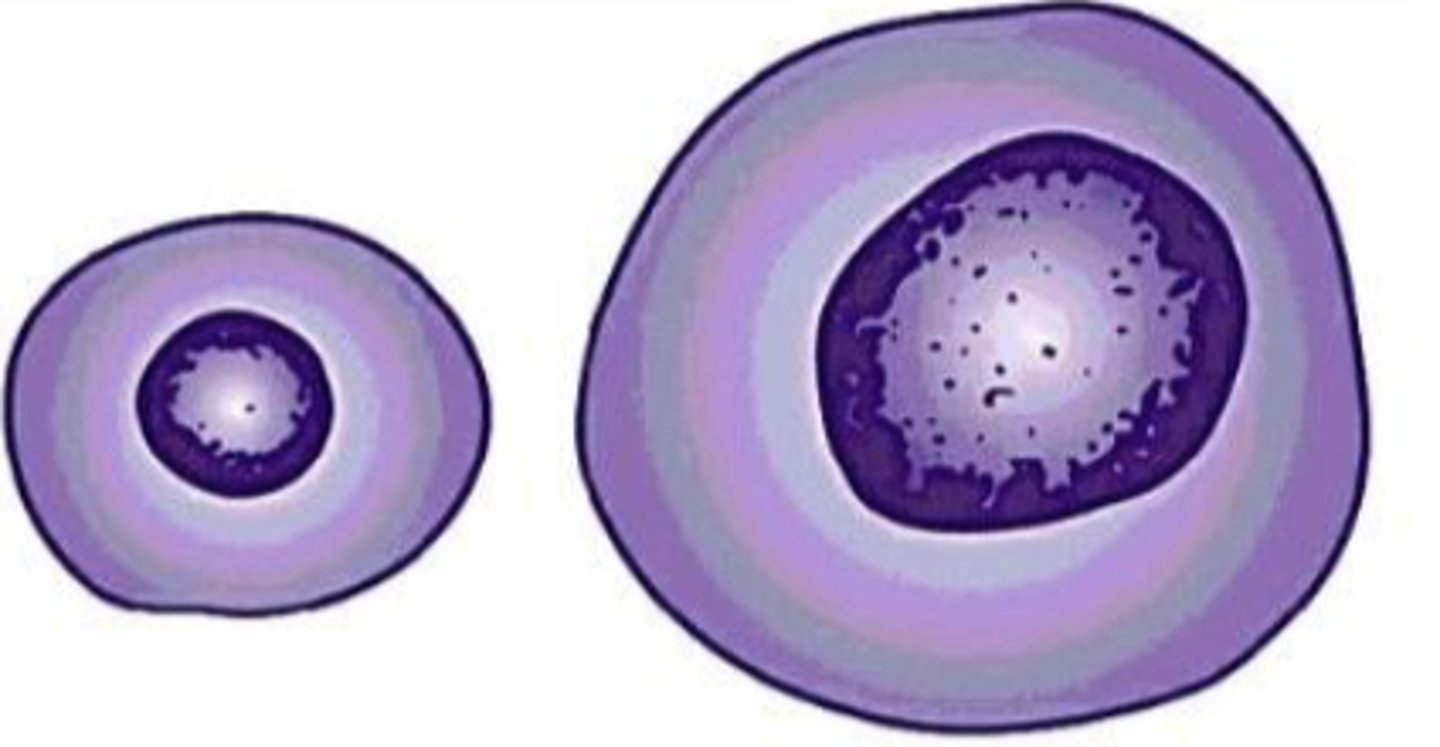 <p>What term is used for cells > 2 times larger than normal?</p>