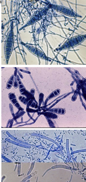<p>Microsporum = Spindle shaped</p><p>Epidermophyton = Beaver’s tail</p><p>Trichophyton = Cigar shaped</p>