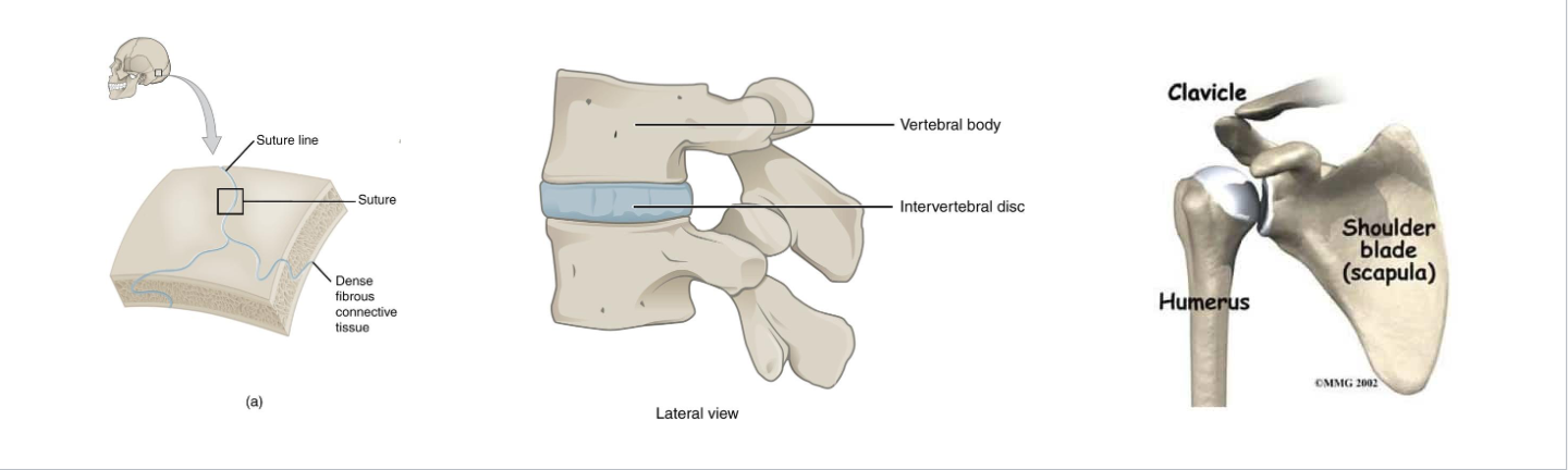 <p>Functional classification of Joints</p>