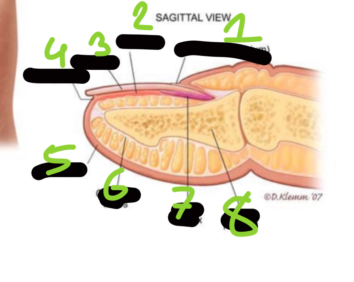 <p>number 3 </p>