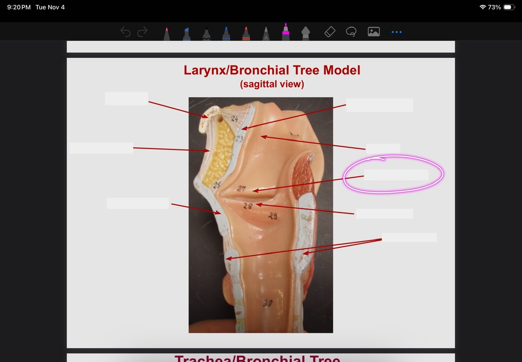 <p>What is this?</p>