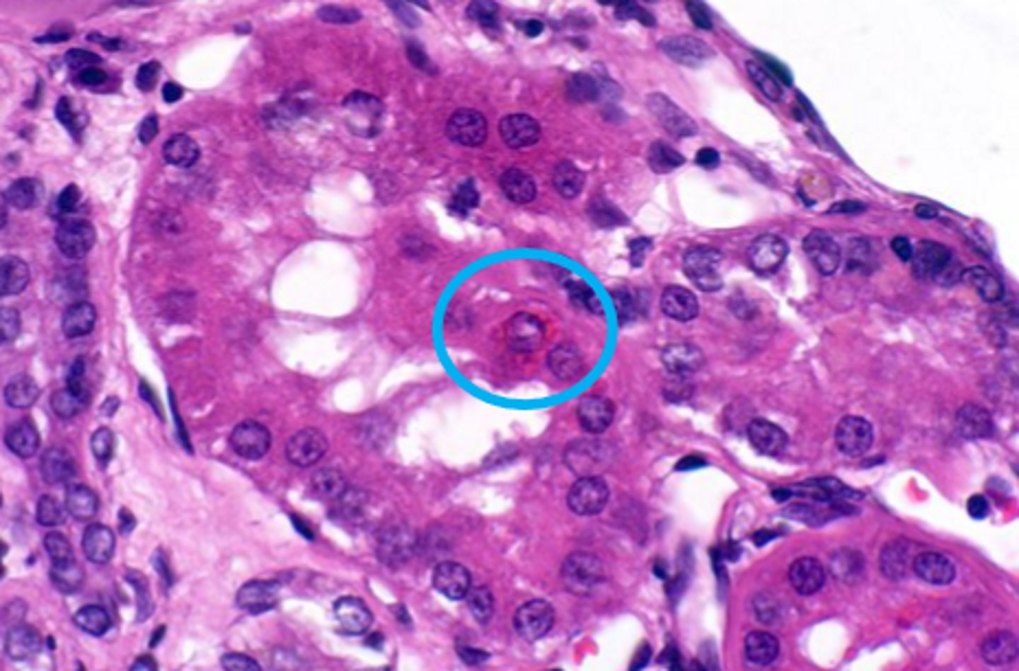 <p>these are renal tubular epithelial cells... what is circled?</p>