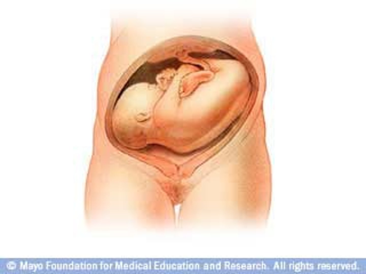 <p>the long axis of the fetus is at a right angle to the clients long axis</p>