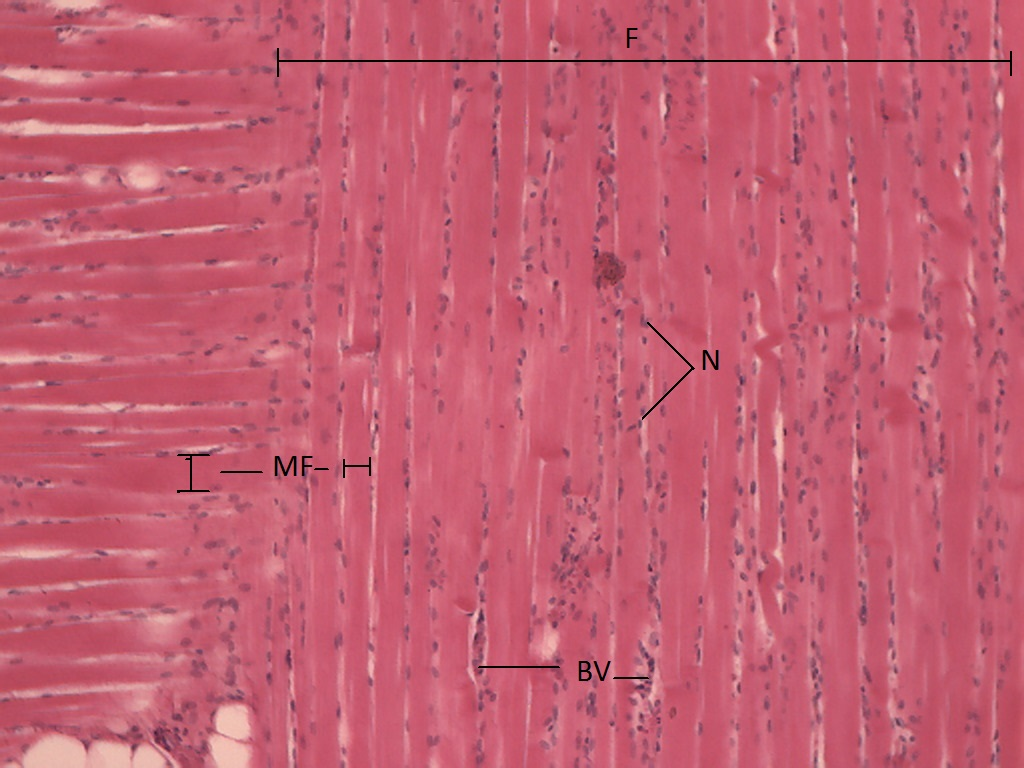 <p>What magnification level are the Skeletal Muscle Cells?</p>