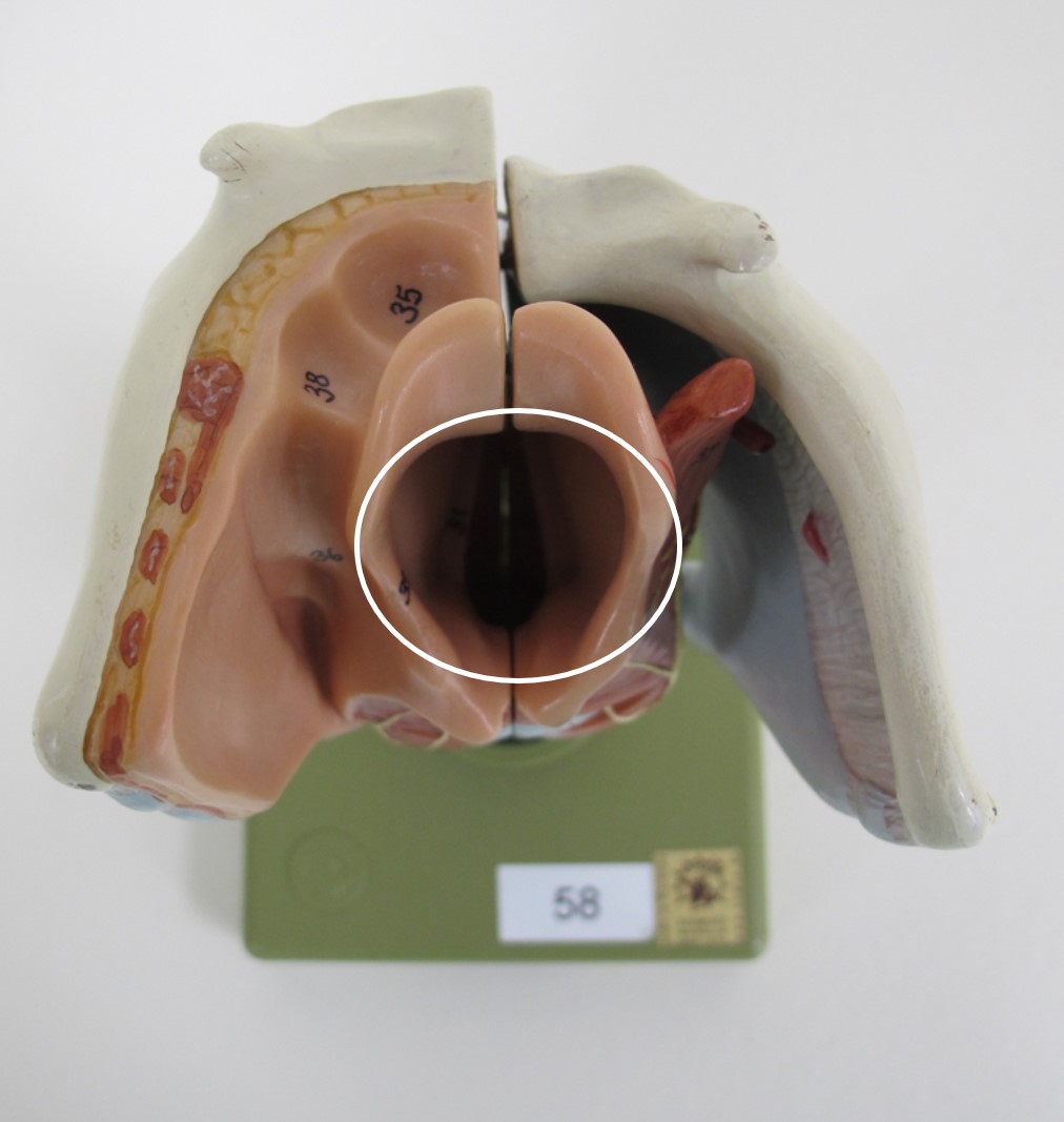 <p>opening dorsaal van epiglottis</p>
