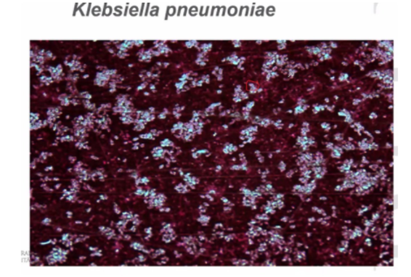 <p>Negatīvā metode (fons iekrāsojas, bet baktērijas neiekrāsojas) → safranīns</p>