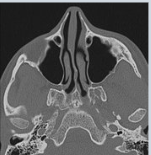 <p>what would be the diagnosis from this scan</p>