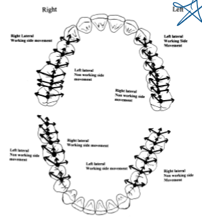 <p>ID the working, nonworking, and protrusive paths</p>