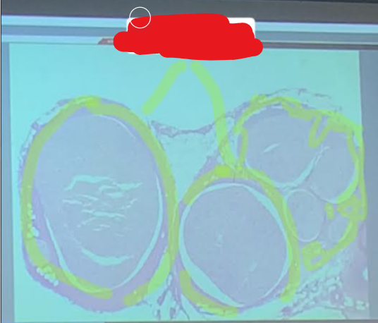 <p>Label This Part</p>