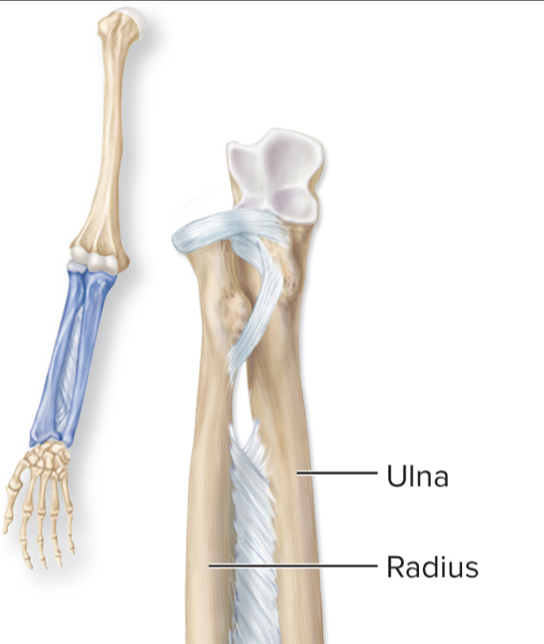 <p>What kind of joint can be found in this image?</p>