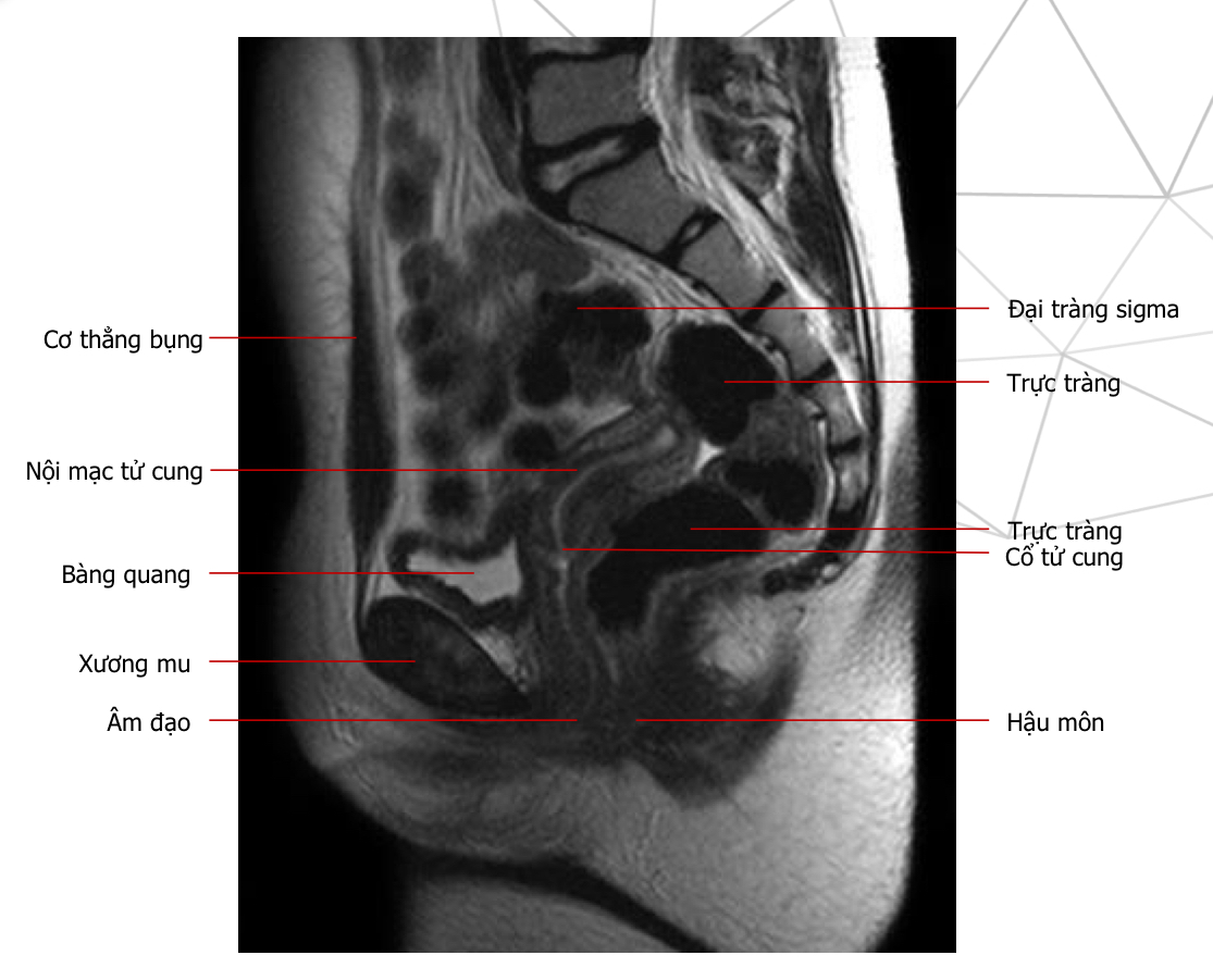 <p>T2w sag, thì nghỉ</p>