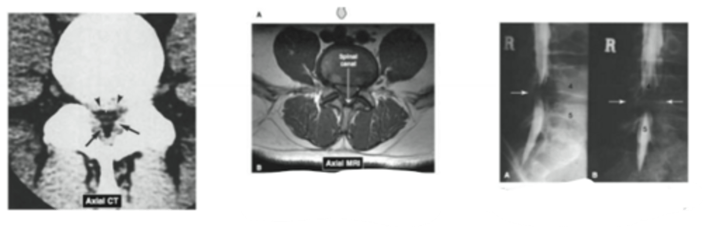 <p>Name the common pathology</p>