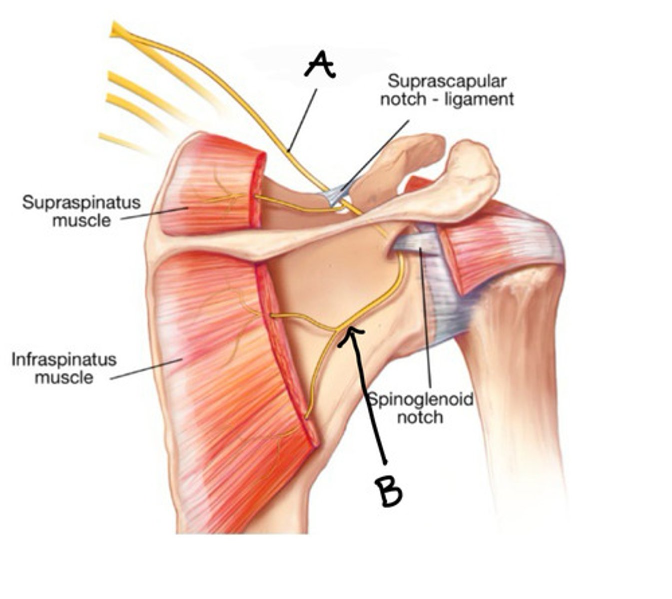 <p>A</p>
