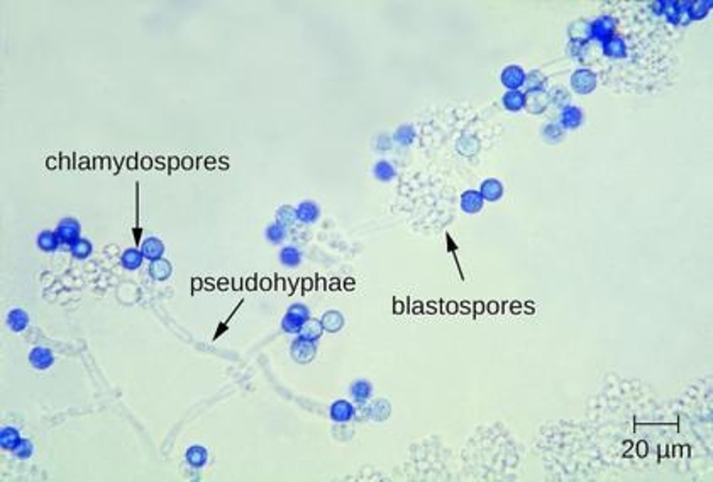 <p>Thick-walled, asexual spore formed by rounding and enlargement of a hyphal cell, not easily dispersed but can survive extreme environmental stress.</p>