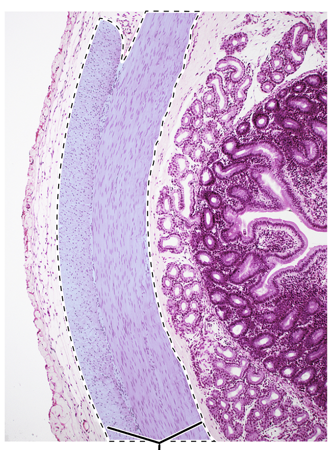 <p>Name the highlighted tissue.</p>