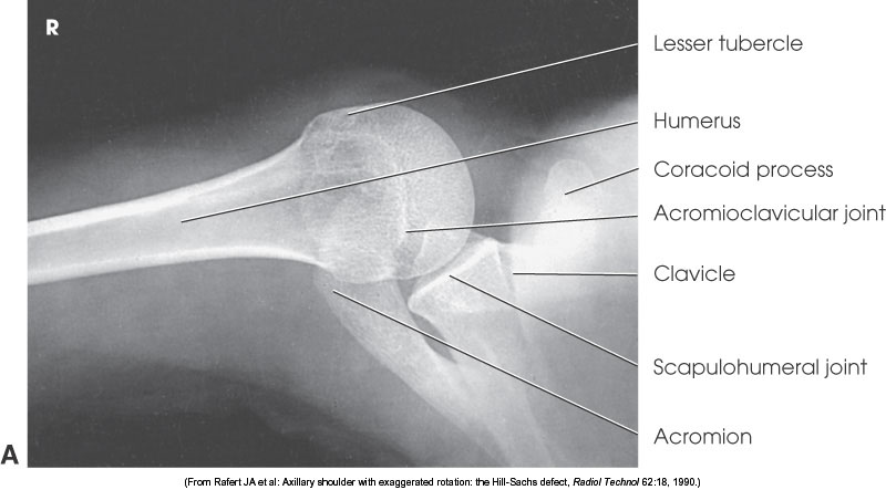 <p>What position is demonstrated?</p>