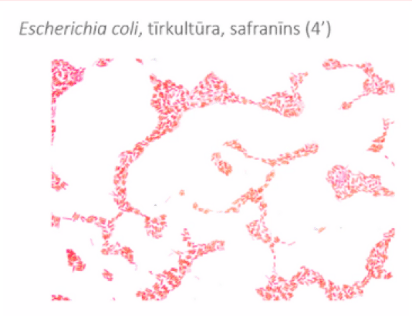 <p>- visas vienādas - tā ir tīrkultūra</p><p>- krāsojuma metode - redzam sarkano krāsu, tātad safranīns</p><p>Preparāta nosaukums: bakt nosaukums, tīrkultūra/jaukta kultūra, krāsa</p><p>4' = minūtes, cik ilgi turēja krāsu</p>
