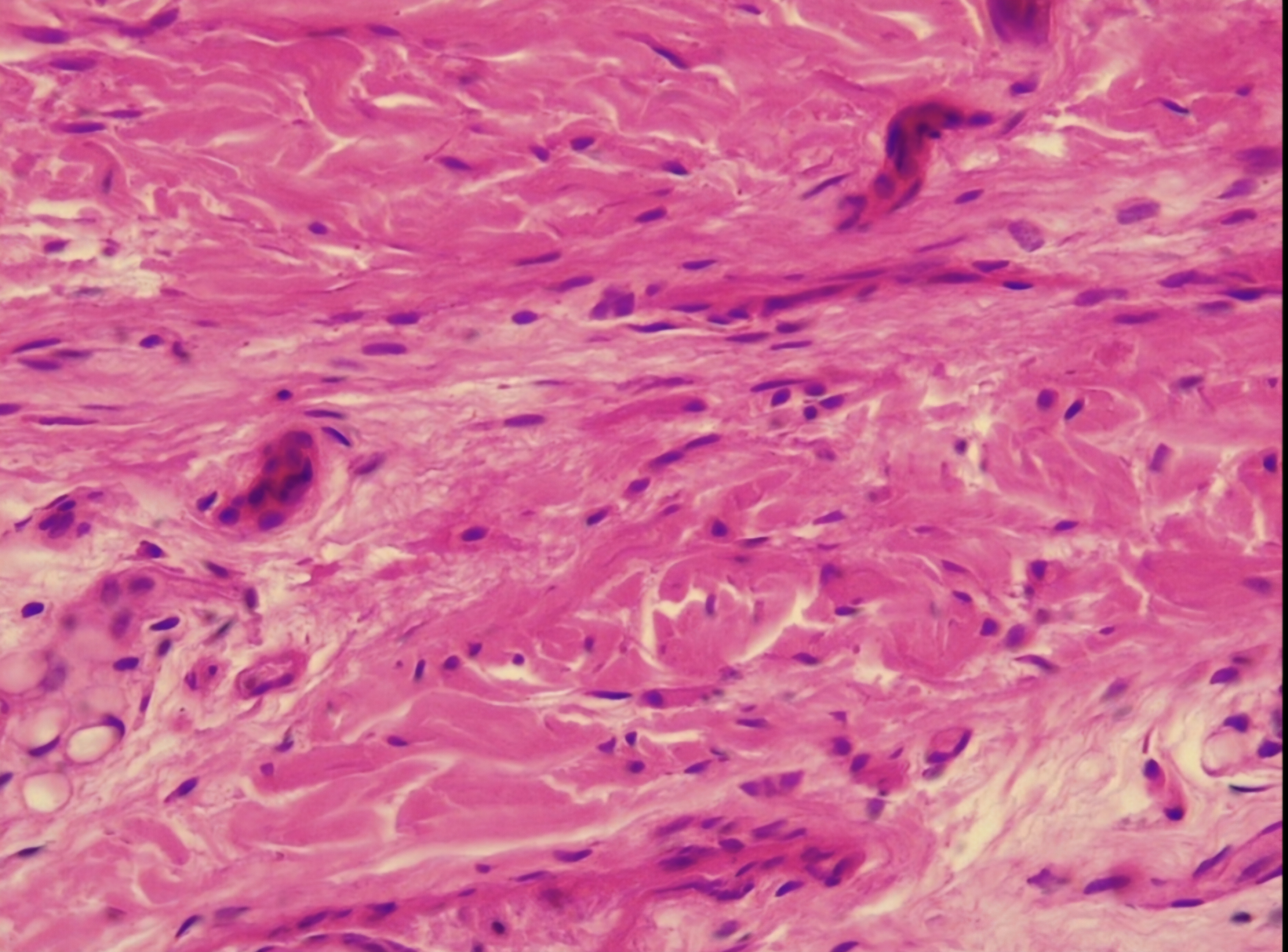 <p>Dense Irregular </p>