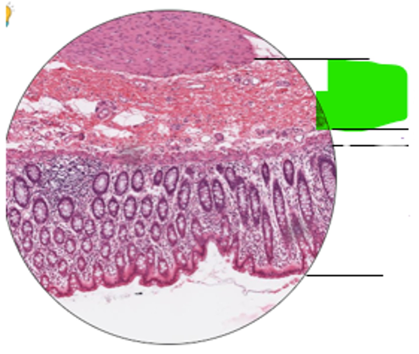 <p>region and organ?</p>