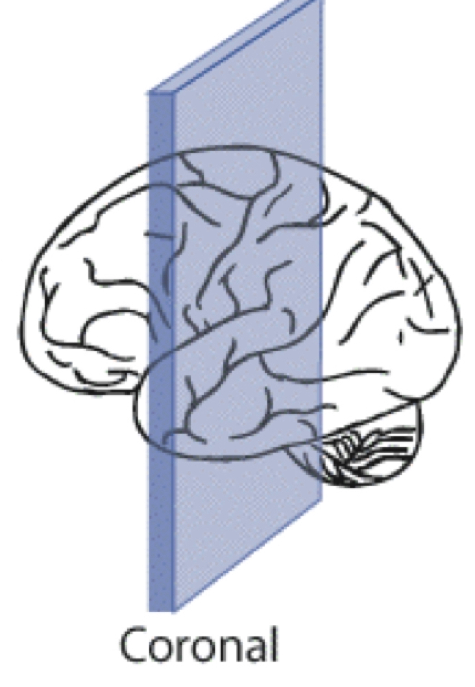 <p>front and back halves (anterior and posterior) </p>