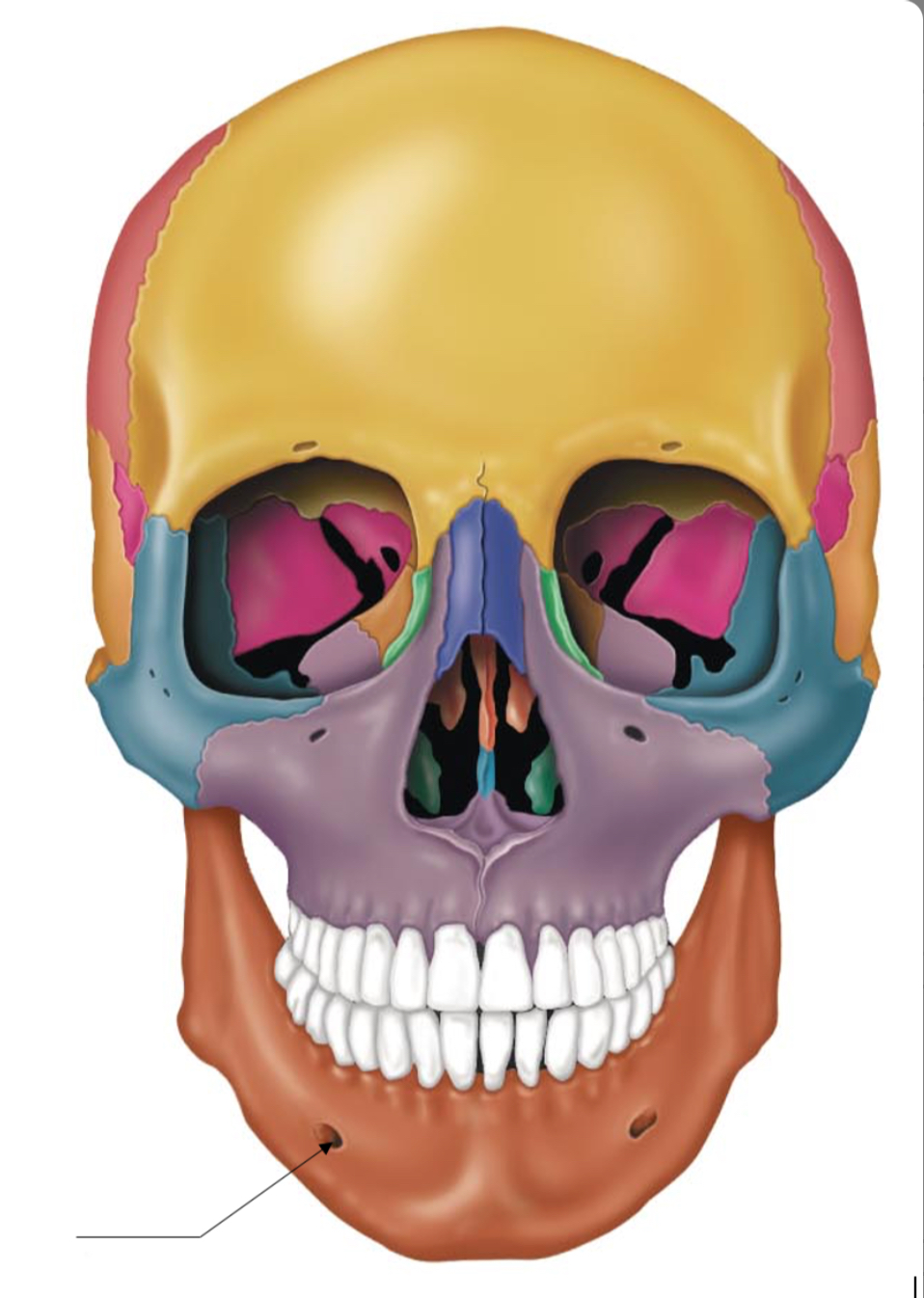 term image
