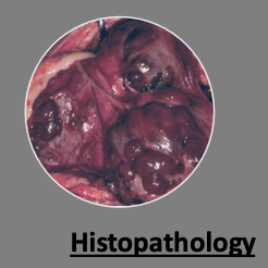 <p>yes, it is often required for definitive diagnosis</p><p>difficult to do with widespread necrosis and hemorrhage (will need multiple sections/cuts)</p>