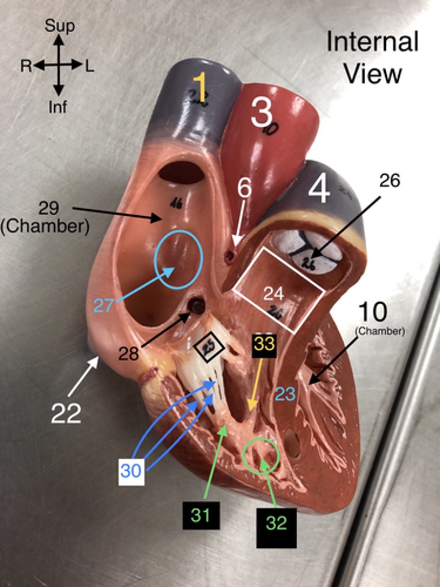 <p>24. The outflow tract from the right ventricle leading to the pulmonary trunk.</p>