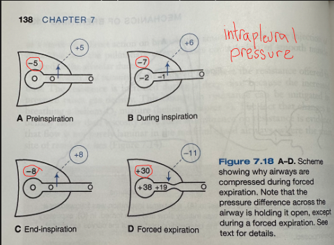 <ul><li><p>A - preinspiration</p><ul><li><p>Airway pressure everywhere is zero (no flow)</p></li><li><p>Because intrapleural pressure is -5 cmH2o, there is a pressure of 5 cmH2O (transmural pressure) holding the airway open</p></li></ul></li><li><p>B - during inspiration</p><ul><li><p>As inspiration starts, both intrapleural and alveolar pressure fall by 2 cmH2O and flow begins</p></li><li><p>Because of the pressure drop along the airway, the pressure inside is -1 cmH2O and there is a pressure of 6 cmH2O holding the airway open</p></li></ul></li><li><p>C - end inspiration</p><ul><li><p>Flow is again zero and there is an airway transmural pressure of 8 cm water</p></li></ul></li><li><p>D - forced expiration</p><ul><li><p>At the onset of forced expiration, both intrapleural pressure and alveolar pressure increase by 38 cmH2O</p></li><li><p>Because the pressure drop along the airway as flow begins, there is now a pressure of -11 cm of water which tends to close the airway</p></li><li><p>Airway compression occurs and the downstream pressure limiting flow becomes the intrapleural pressure so the effective driving pressure becomes alveolar minus intrapleural pressure</p><ul><li><p>If intrapleural pressure is raised further by increased muscular effort in an attempt to expel gas, the effective driving pressure is unaltered because the difference between alveolar and intrapleural pressure is determined by lung volume</p></li></ul></li></ul></li><li><p>Flow is independent of effort</p></li><li><p><span>Flow is independent of the resistance of the airways downstream of the point of collapse</span></p><ul><li><p><span>Equal pressure point - point of collapse</span></p></li><li><p><span>As expiration progresses, the equal pressure point moves distally, deeper into the lung because the resistance of the airways rises as lung volume falls and therefore the pressure within the airways falls more rapidly with distance from the alveoli</span></p></li></ul></li></ul><p></p>