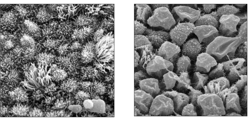 <p>Where is this epithelium</p>