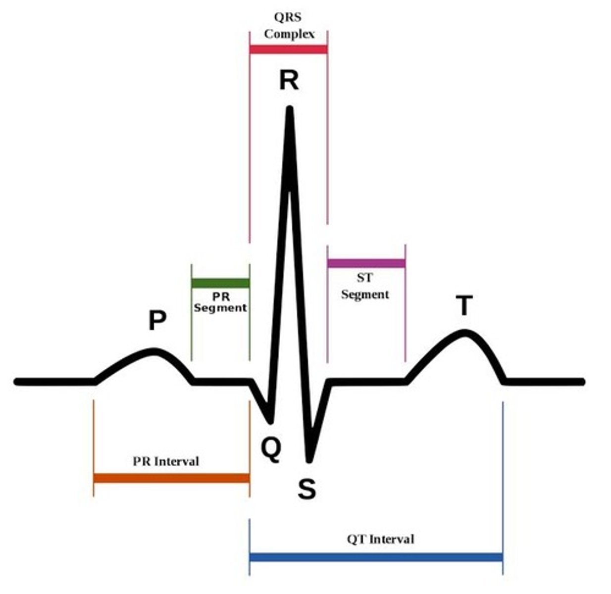 <p>P wave measurements</p>