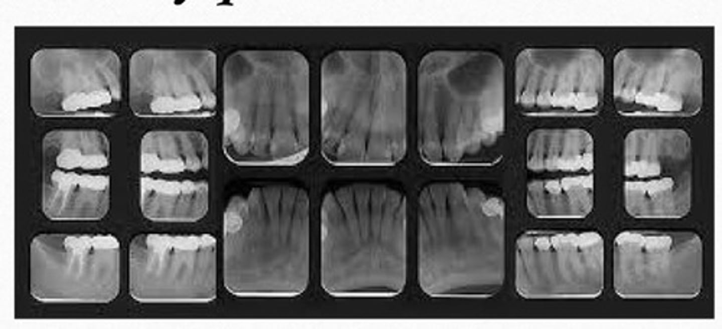 <p>is composed of a series of individual images, including a combination of bitewing & periapical</p>